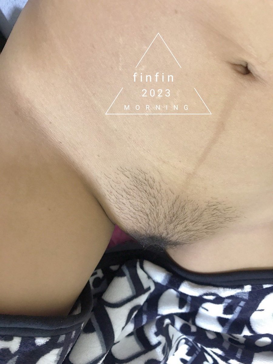 เช้านี้ ง่วง 😴 หรือ เงี้ยน💦