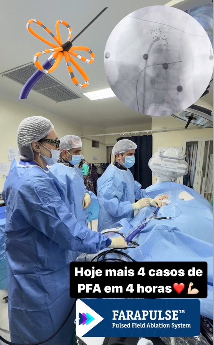 CarinaHardy4's tweet photo. #EPeeps today we performed 4 PFA cases in 4 hours. Impressed with the short time and effectiveness to PVI. 
Thanks @Aperezsilva77 and Dr German 
@fariasdritmo @PauliAndre https://t.co/dGbkI3N82r