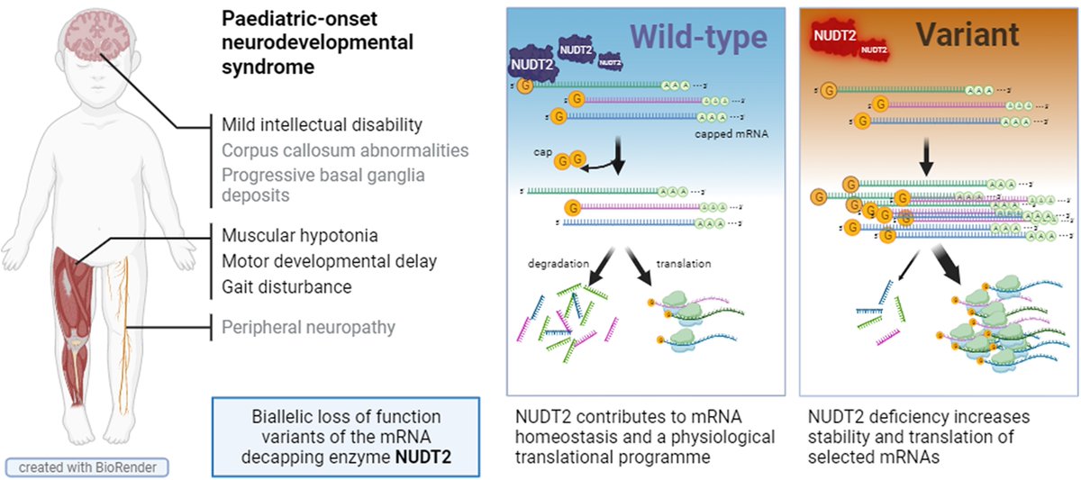 Husain et al. describe a recessive neurodevelopmental disorder characterized by intellectual disability, motor developmental delay and peripheral neuropathy, and associated with loss-of-function of the NUDT2 protein through disruption of mRNA homeostasis. tinyurl.com/2ex4y8bv