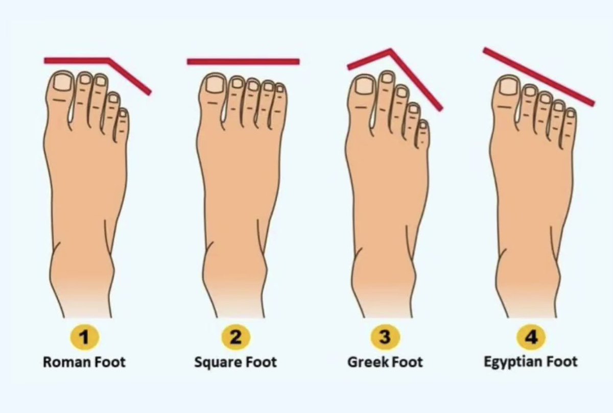 How is the shape of your foot?🧐 1? 2? 3? 4?