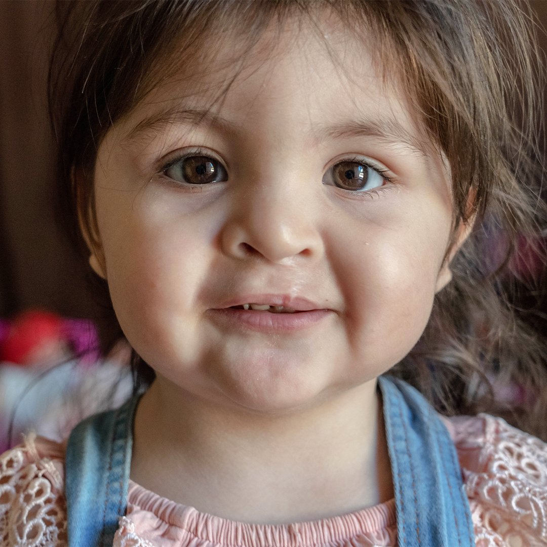 Who remembers Luaxana, a Smile Train-supported patient from Argentina? When her parents discovered that their baby had a cleft, they panicked. But soon, they found help through out partner, PIEL Asociación, and now Luaxana is living the healthy & happy life she deserves!