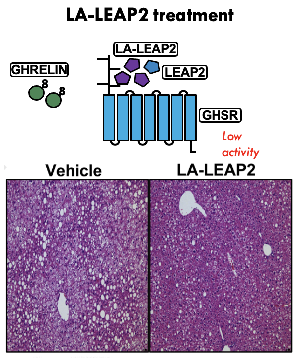 A long-acting #LEAP2 agonist as a new treatment for #MAFLD #fattyliver and #obesity ? @oceankripa and the rest of the @ZigmanLab say YES! #ghrelin

authors.elsevier.com/sd/article/S22…
preprint now available @MolMetab 

@UTSWMedCenter @UTSWInternalMed @UTSWBrain @UTSWdiabetes