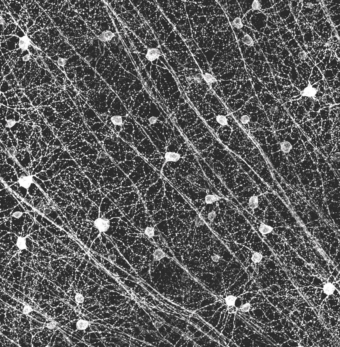 M2 and M4 ipRGCs in the mouse retina 👁️🐭