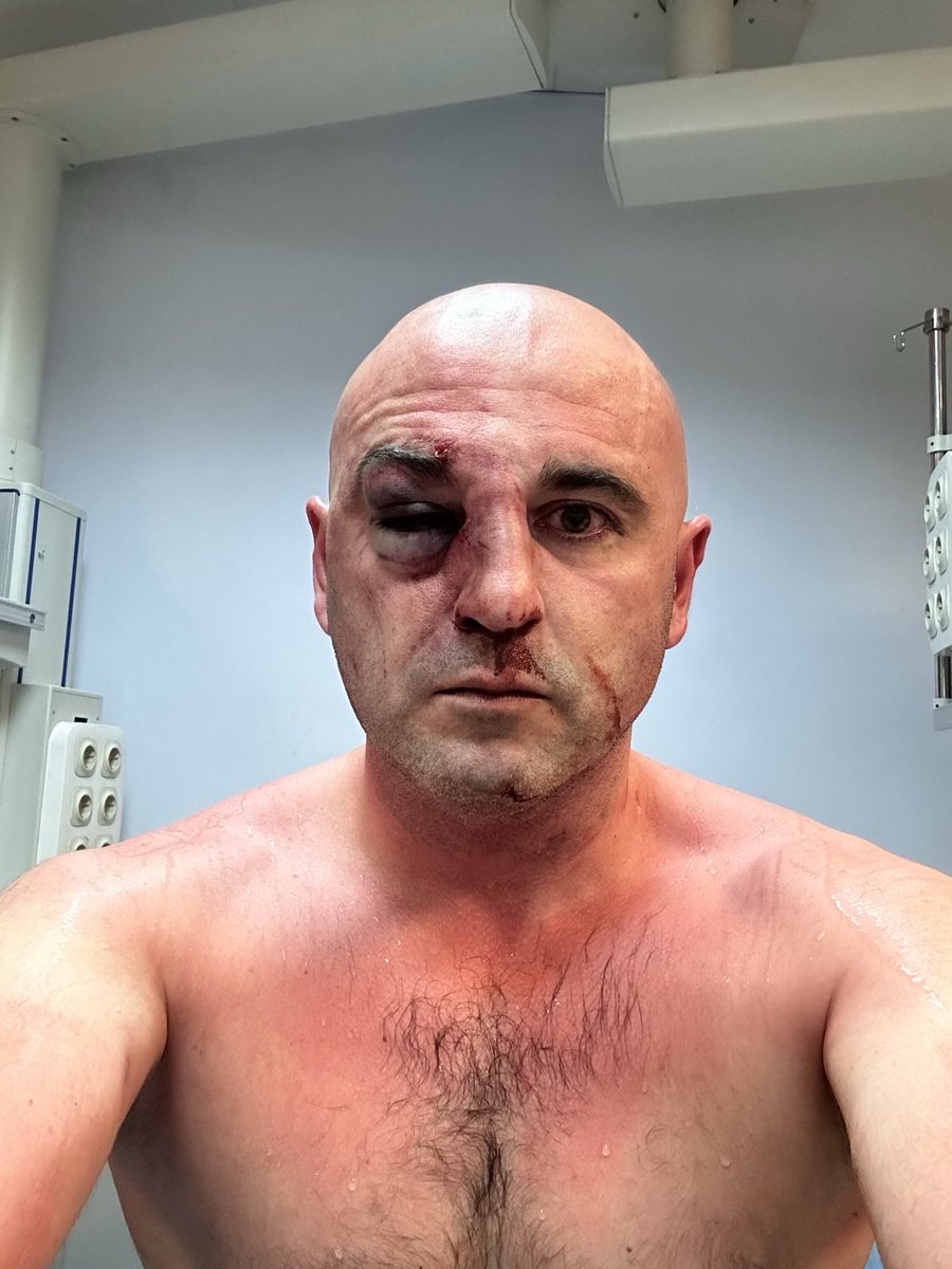 The chairman of @UNMGeorgia was was beaten by special forces of #Georgia