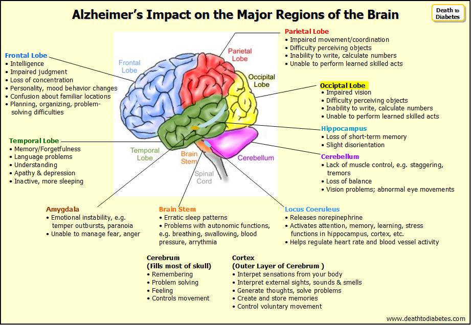 #Alzheimers Impact on Major Regions of the Brain #dementia #health