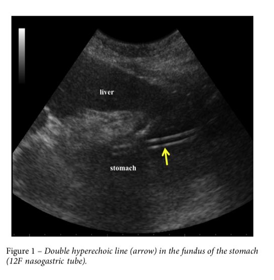 EmergPOCUS tweet picture