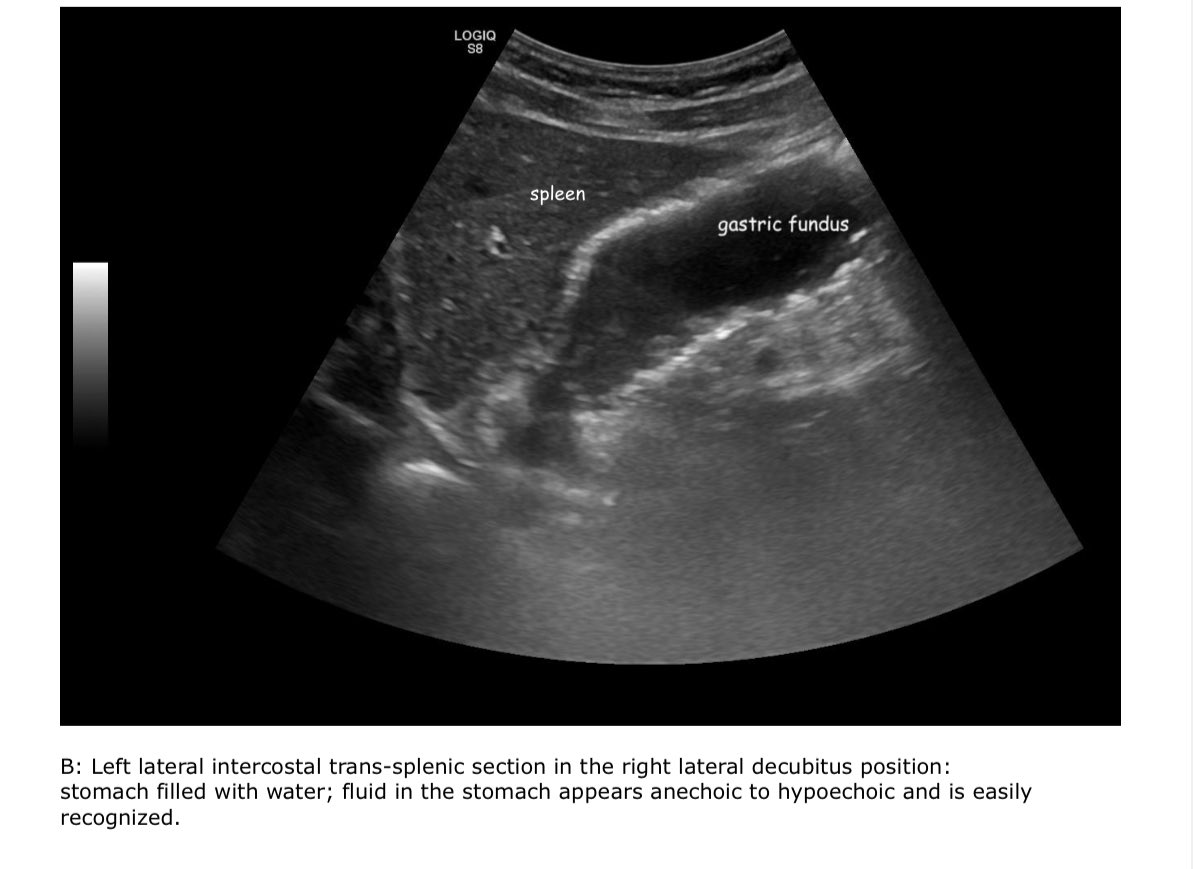 EmergPOCUS tweet picture