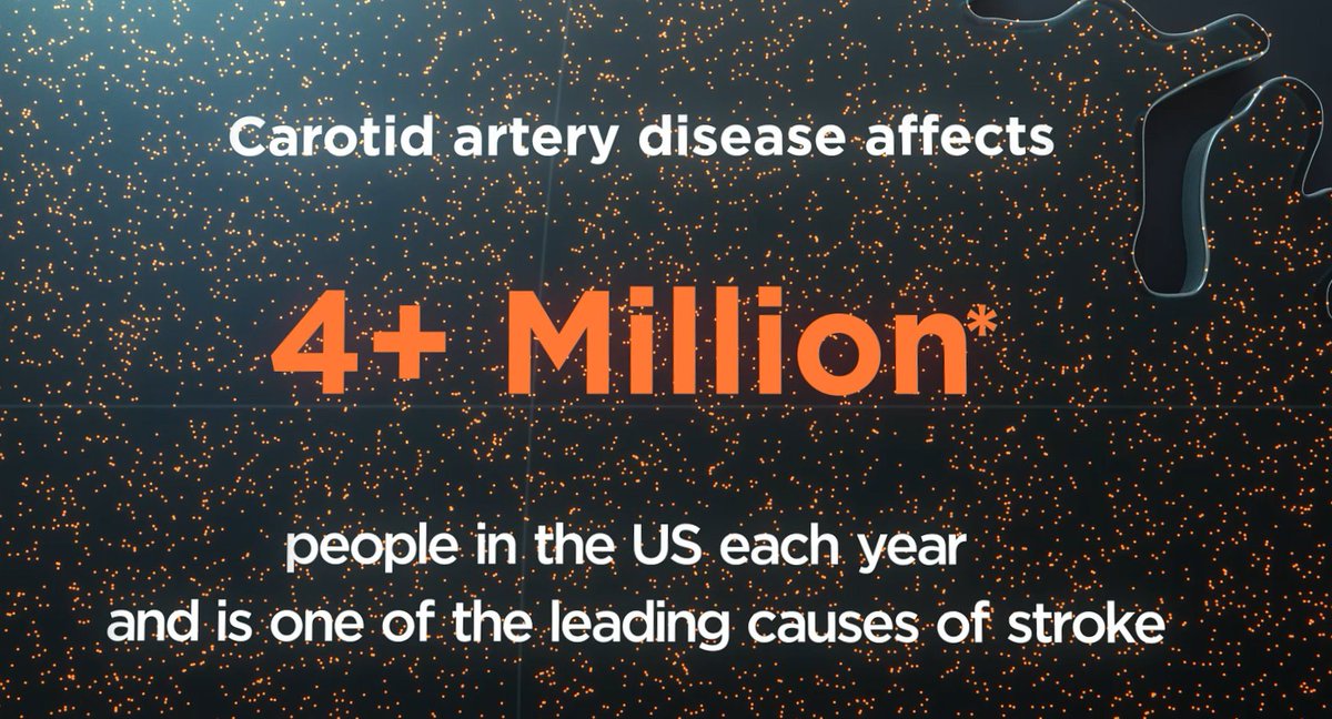 SilkRoadMed's tweet photo. Carotid artery disease affects over 4M people in the US each year &amp; is one of the leading causes of stroke. Certain treatment options like #CEA &amp; #TFCAS present challenges and complications. Learn more about why patients prefer TCAR, a less invasive option https://t.co/1OSw3qEY8M https://t.co/84I5J8ntN0