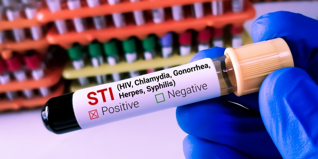Sexually transmitted infections (STIs) are common and can have serious health consequences if left untreated. Fortunately, most STIs are treatable and can be resolved with the right care and treatment. Find the best preventive methods and treatments ➡️ scripps.org/6839t