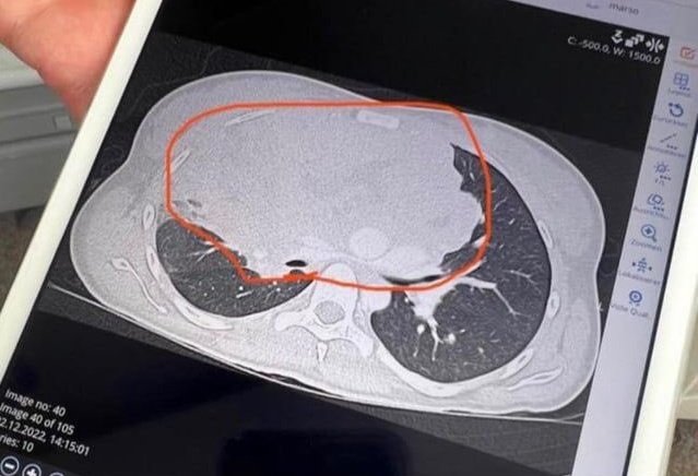 Jeremy Renner tweet media