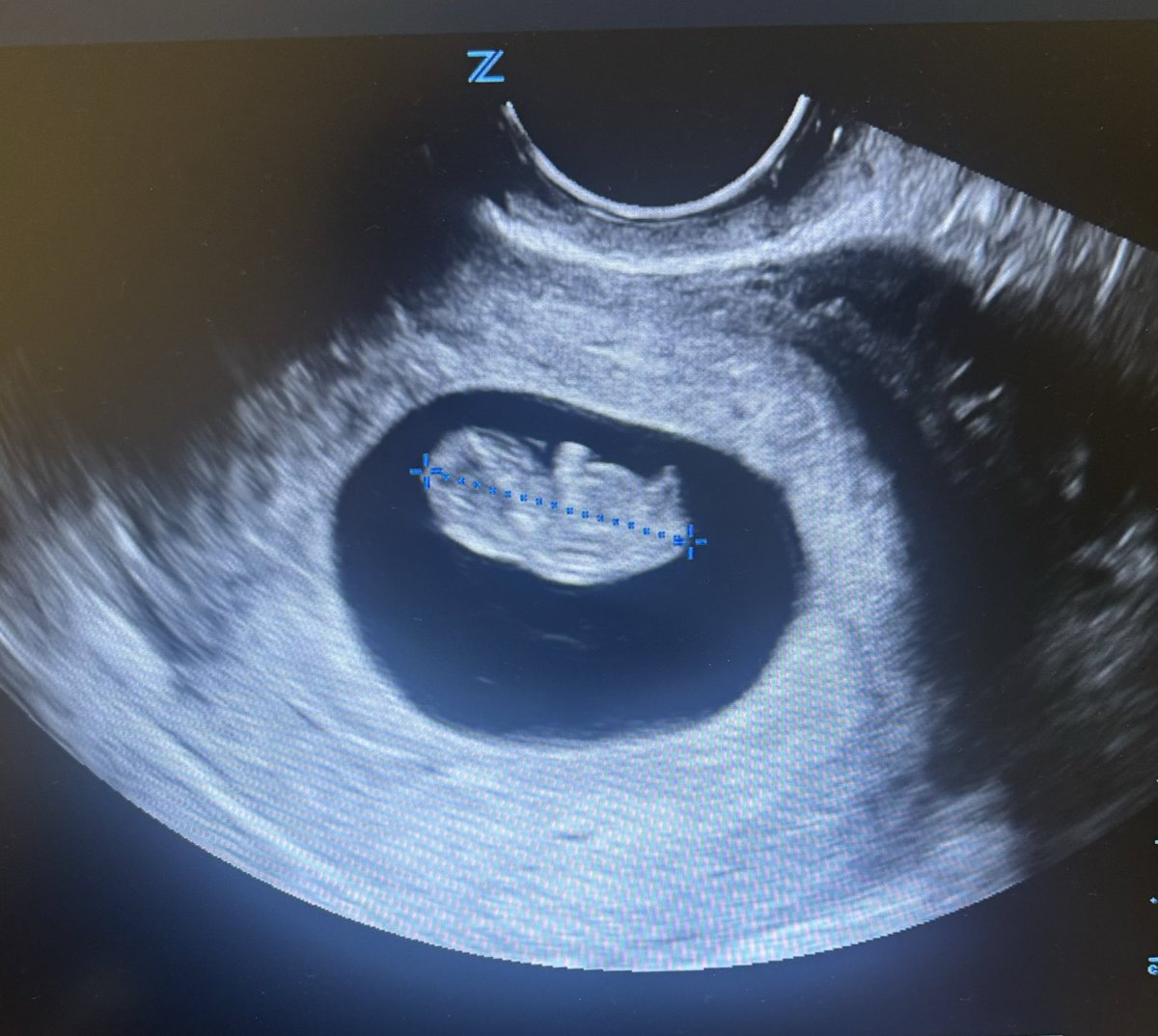 And the family continues to grow 💕 #aunty