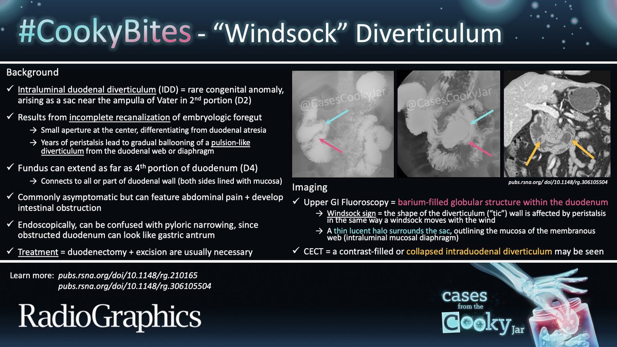 Answer: “Windsock” Diverticulum Learn more: 🔗pubs.rsna.org/doi/10.1148/rg… 🔗pubs.rsna.org/doi/10.1148/rg… #CookyBites #161 #RGphx @cookyscan1 @RadioGraphics