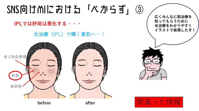 メディカルイラストレーションを書くうえでの注意事項。
わかりやすくするつもりで図解をしたつもりでも、勉強不足だと間違ったことを描いて広めてしまう可能性があります。きちんと下調べ、勉強したうえで描かないといけません。 