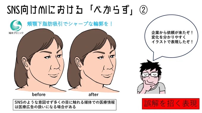 メディカルイラストレーションを書くうえでの注意事項2。

手術の変化の図示は誇張が含まれやすく術前後のbefore,afterを提示するには相応しくありません。変化はかならず期間を明示した上、角度を揃えた写真ですべきです。 