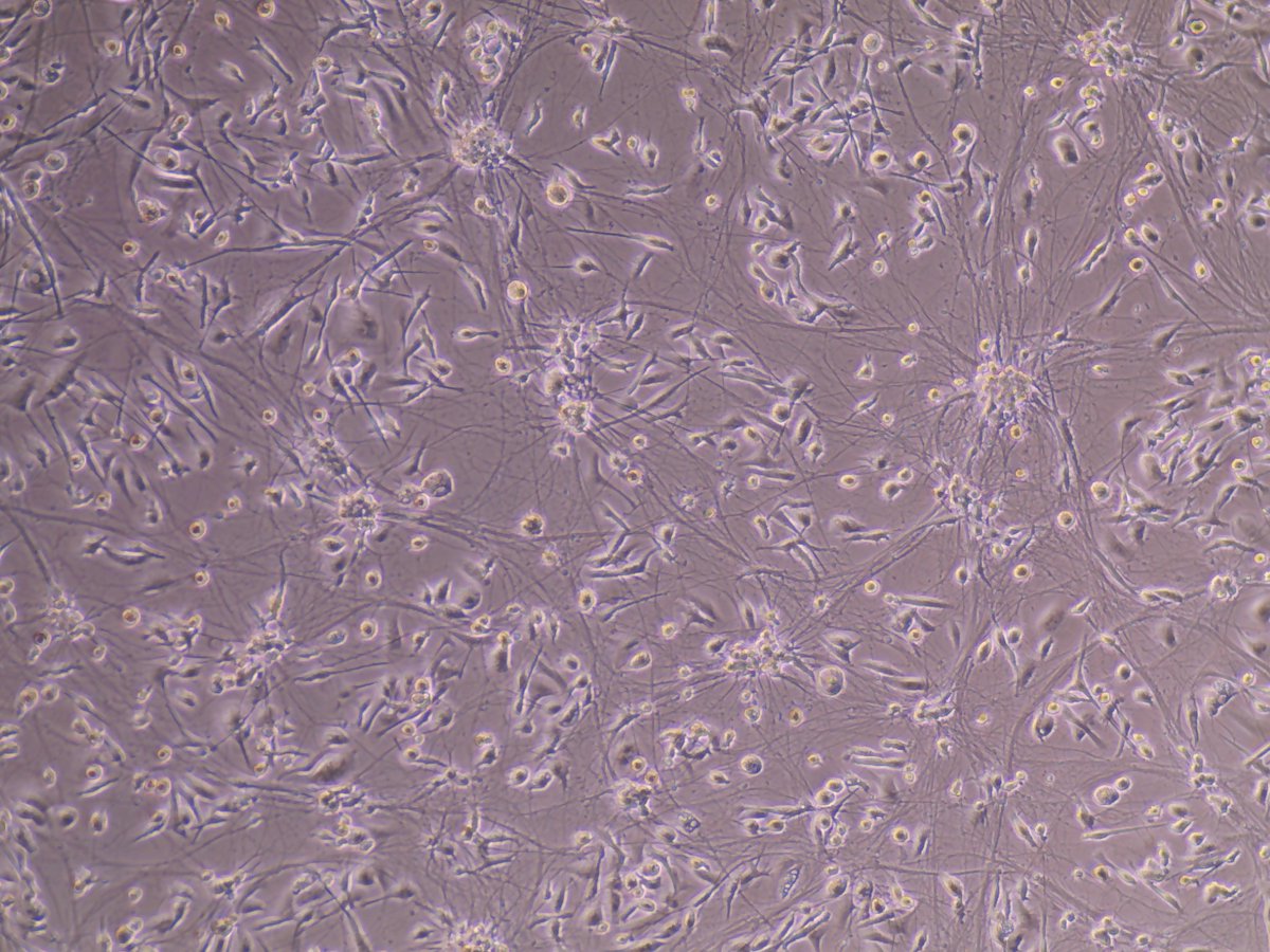 Wednesday cellfie: KOLF2.1S iPSC microglial + neuron co-cultures, so pretty😍What's not shown is the pain of optimizing these conditions... Hopefully these models can help us further understand the molecular basis of Alzheimer's disease🧠 #ForACure