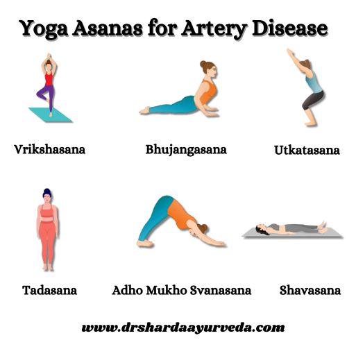 Yoga Asanas for Help to Cure Coronary Artery Disease