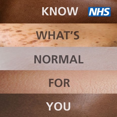 Check your skin. A new mole or a change in an existing mole may be signs of melanoma skin cancer. Melanomas can appear anywhere on your body, but they're more common in areas that are often exposed to the sun. Find out more: nhs.uk/skincancer #SkinCancerAwarenessMonth