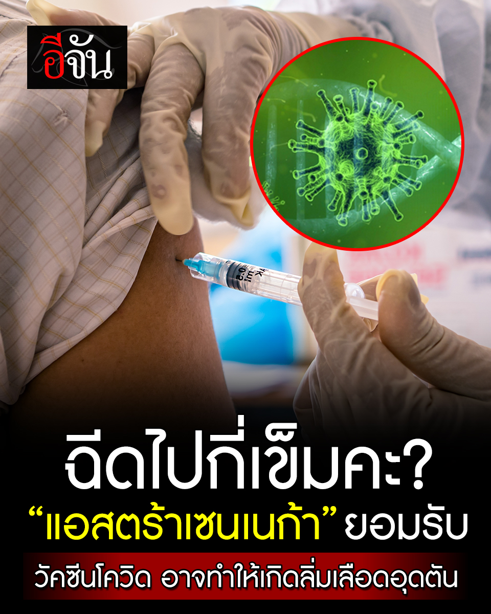 EJanNews's tweet photo. อ้าวเฮ้ย! แอสตร้าเซนเนก้า (AstraZeneca) ยอมรับ วัคซีนโควิด มีผลข้างเคียง อาจทำให้เกิดภาวะลิ่มเลือดอุดตัน-เกล็ดเลือดต่ำ อ่านข่าวต่อ: https://t.co/0oQpbDaqq2 https://t.co/jnblkcIqGe