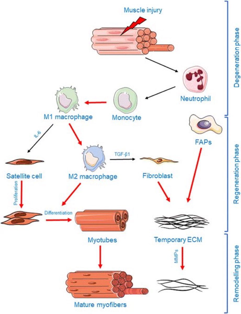 Three phases of muscle repair following injury👇🏼 1. Degeneration phase 2. Regeneration phase 3. Remodelling phase #muscle #injury #repair link.springer.com/article/10.100…