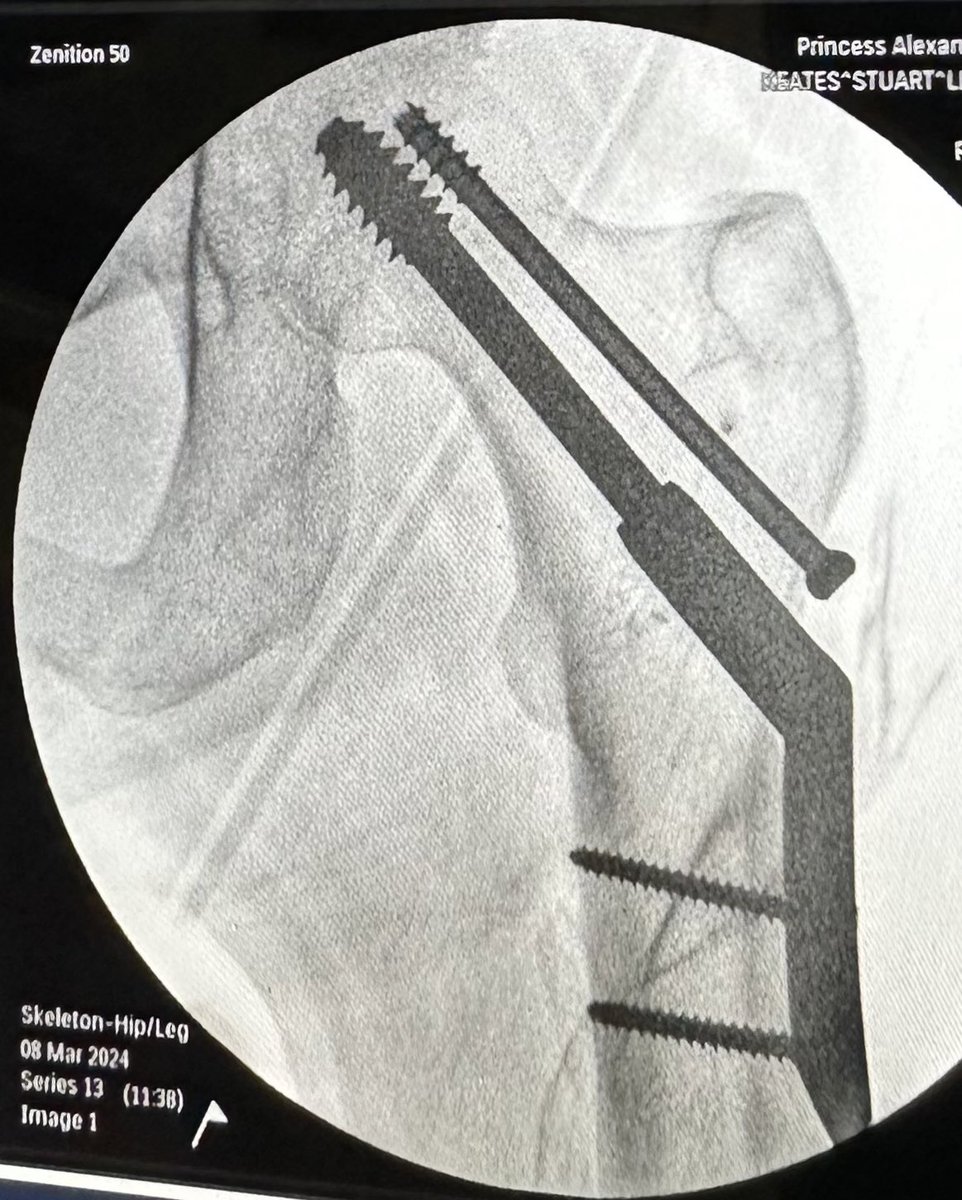 Keatesy  ツ tweet media