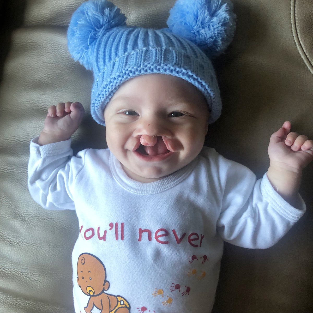 ⭐ 4th-12th May is Cleft Lip and Palate Awareness Week ⭐ Visit CLAPA's Awareness Week Hub at buff.ly/3x7Ubty and help spread the word! Find out more from our Annual Report Summary 👉 buff.ly/4d6yhHJ #CleftAware @CLAPACOMMUNITY
