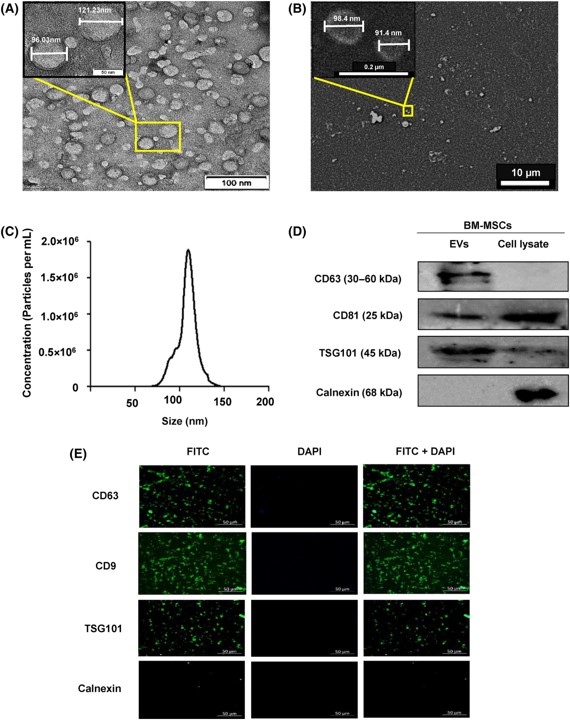 Sachin Shukla et al @lvprasadeye  isolated and analysed EVs derived from human bone marrow MSCs, investigating their influence on epithelial repair and apoptosis in cultured corneal epithelial cells using PCR, immunofluorescence, and flow cytometry
febs.onlinelibrary.wiley.com/doi/10.1002/22…