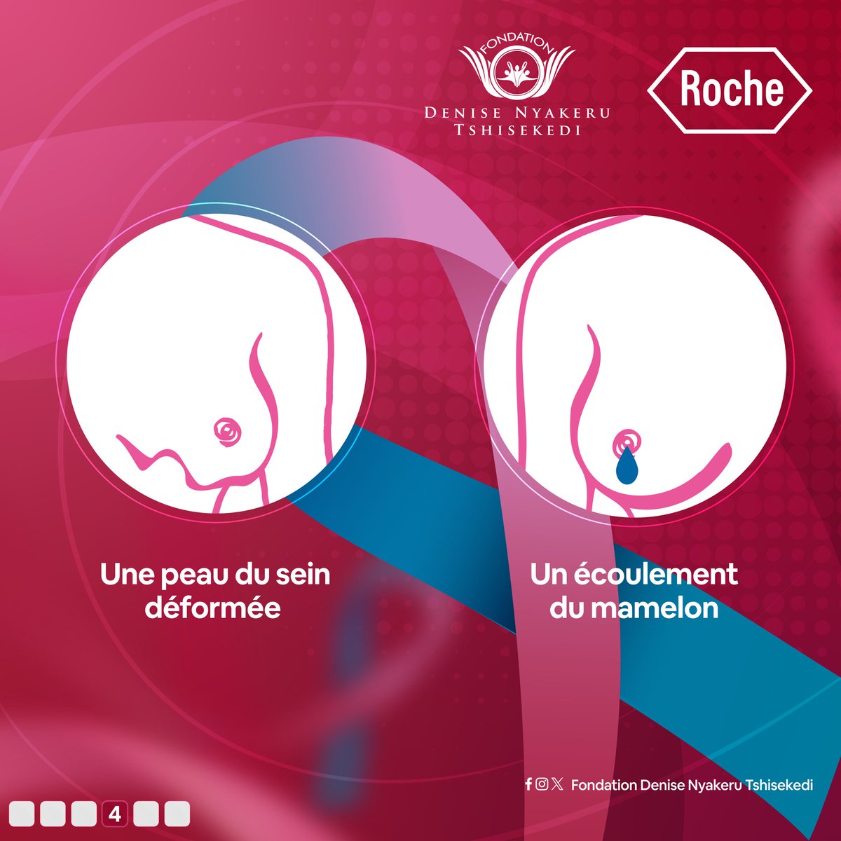 Soyez à l'écoute de votre corps.
Savoir reconnaître les signaux d'alerte du cancer du sein peut faire toute la différence. Ne négligez aucun signe et consultez votre médecin en cas de doute.
#FDNT #Roche #CampagneContre #LesCancersDuSeinEtDuColDeLutérus