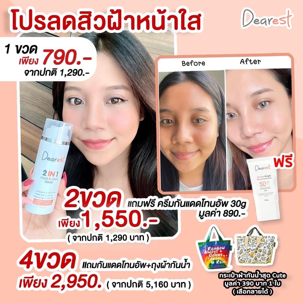 dearestbrand's tweet photo. 5.5 เริ่มแล้ว (!!!) ลดสิวฝ้าหน้าใส
2แถม1🔥4แถม2 🔥 คุ้มมาก ‼เซรั่มล้างหน้าเดียร์เรส #ล้างลดสิวสลายฝ้า แค่ล้างหน้าทุกวัน ฝ้ากระจางลง สิวไม่ขึ้น ด้วยสารสกัดเข้มข้น�💧คอลลาเจนและวิตามินซี
#ยิ่งล้างยิ่งใส #ยิ่งมาส์กยิ่งเด้ง #Dearest
 #เดียร์เรส
🥰 https://t.co/xG6eJhnfRk