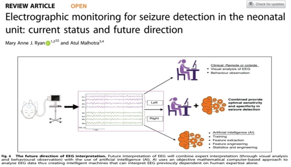 Delighted to be published in Pediatric Research with @Atul_Monash  as part of the ESPR mentor/mentee program. Some work done...but a lot more to do 🧠 
@ESPR_ESN @infantcentre @nbcirl @Newborn_brain  @NewbornBrains 
nature.com/articles/s4139…