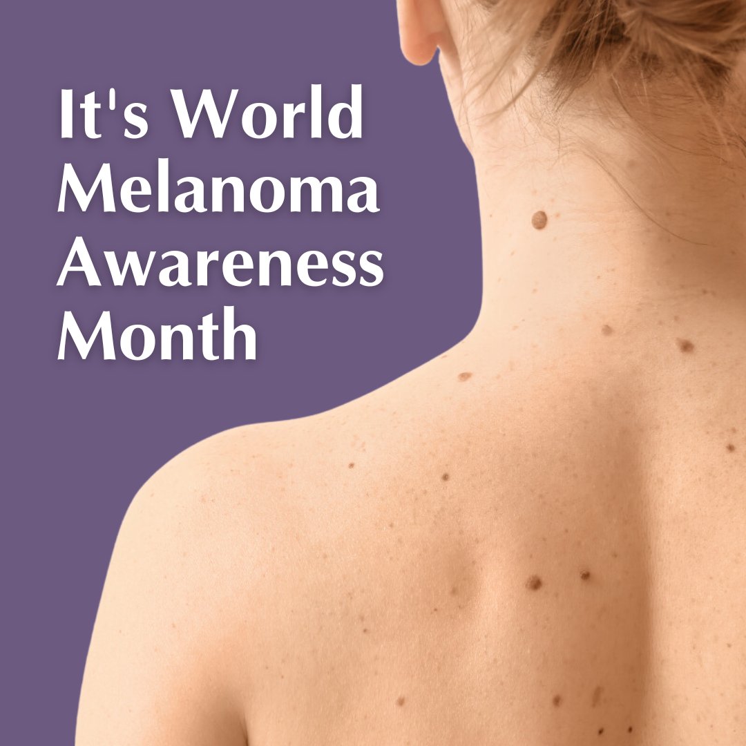 May is World Melanoma Awareness Month, a time to raise awareness of melanoma and the importance of skin cancer prevention and early detection. For a full skin check, visit your GP or dermatologist. To find a dermatologist, use ACD’s Find a Derm tool dermcoll.edu.au/find-a-derm/