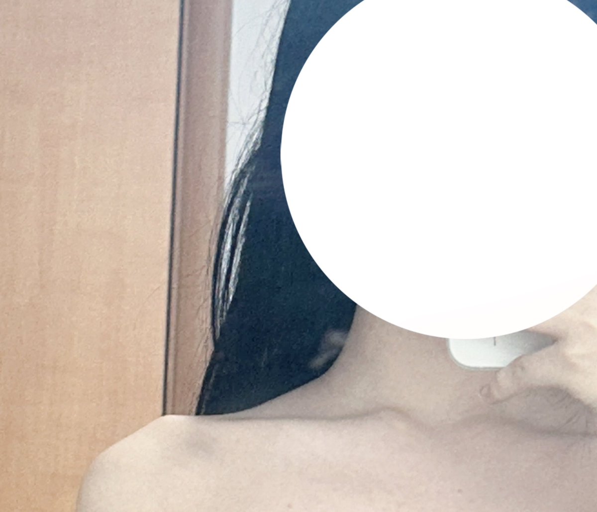 제 무보정 어깨가 요렇습니다
승모근이쪼금있긴하지만,,
매일매일 하는 운동 타래로 공유할게요