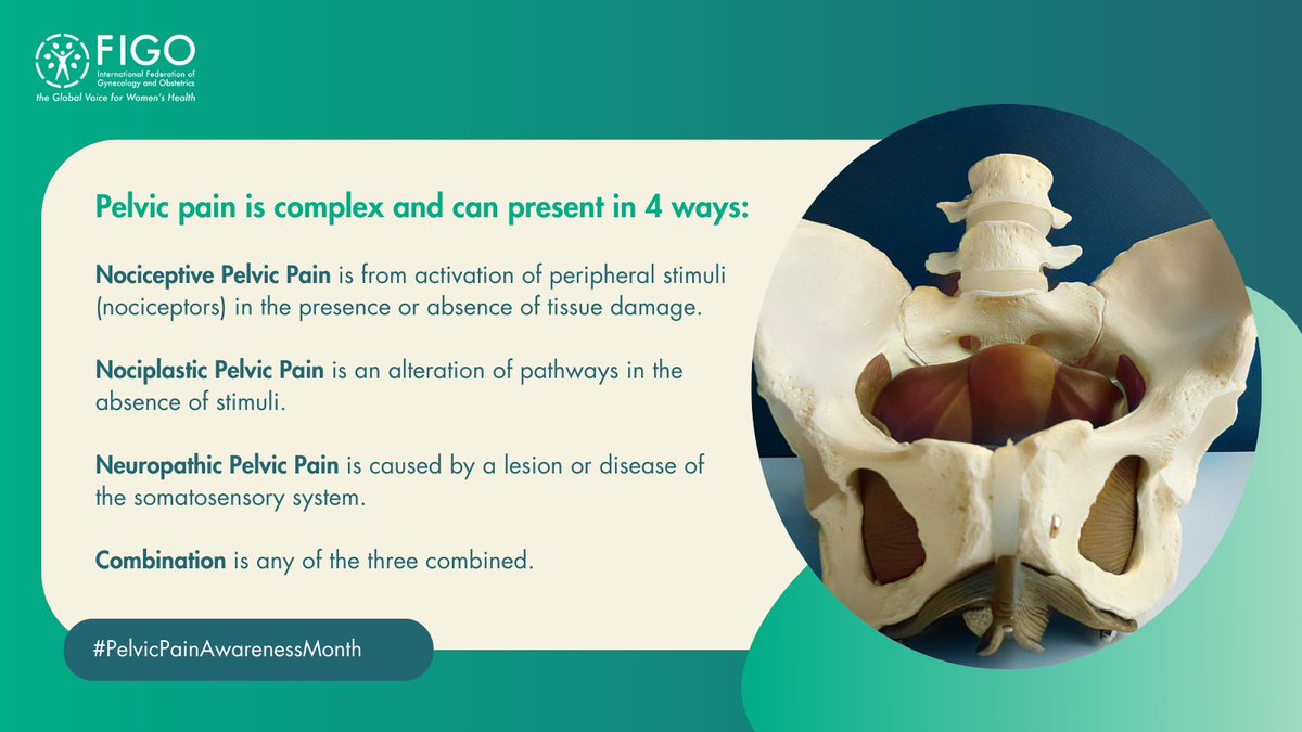 Pelvic pain is complex, presenting in 4 ways: Nociceptive (from stimuli), Nociplastic (altered pathways), Neuropathic (due to lesions/disease), or a combination of the 3. Stay tuned for insights from Prof. Magali Robert, FIGO Committee Chair! #PelvicPainAwarenessMonth