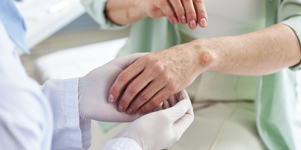 Skin cancer diagnostic company AI Medical Technology raises SEK12m (US$1m) via an oversubscribed bridge financing round in anticipation of a significant Series A later this year. healthtechdigital.com/skin-cancer-di… #Digitalhealth #NHS #Healthcare