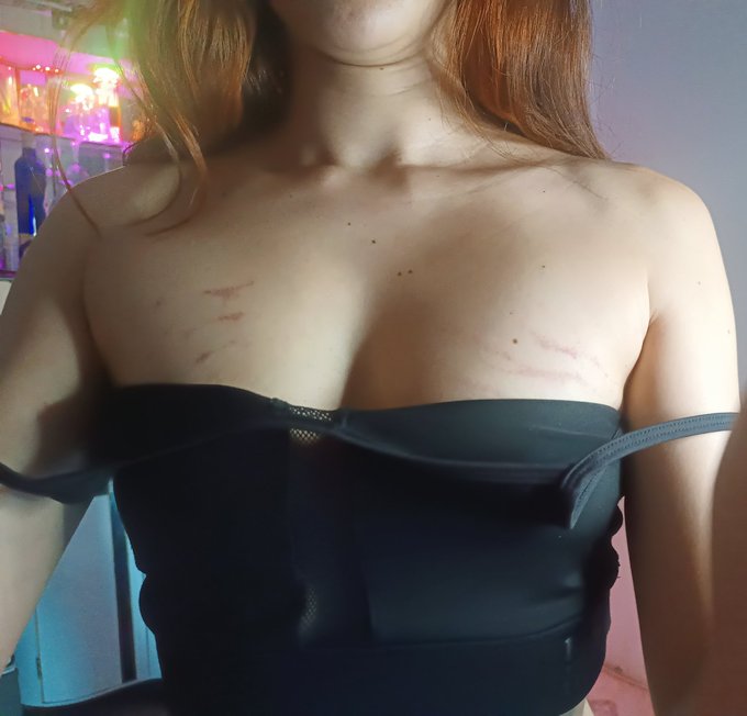 MialozanoX