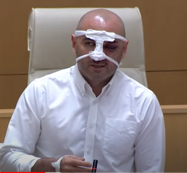 Georgian opposition MP Levan Khabeishvili -- beaten by police at last night's protest in Tbilisi -- speaking in parliament today against the 'foreign influence' bill