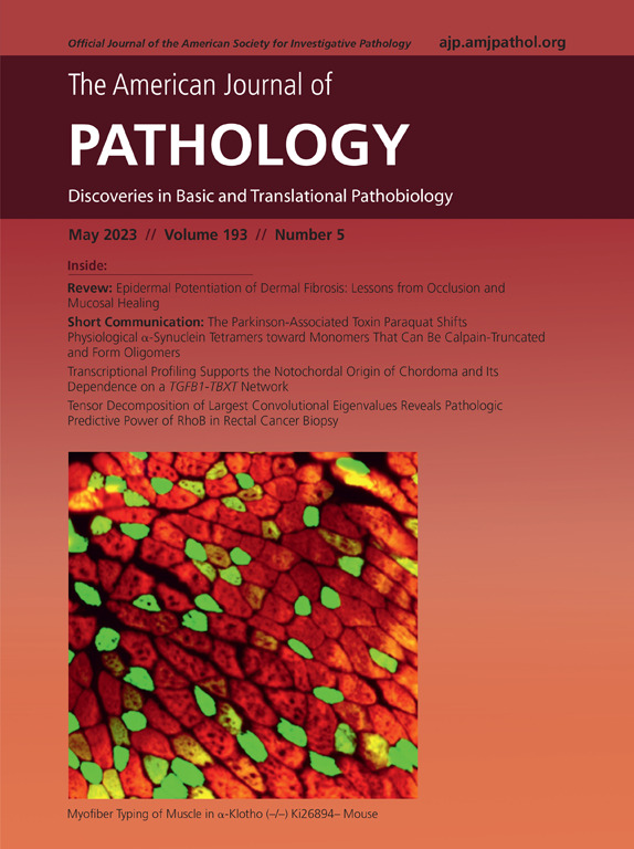 New month, new #LegacyContent! The May 2023 issue of @AJPathology is now fully free in the #OpenArchive. Full issue: ajp.amjpathol.org/issue/S0002-94…