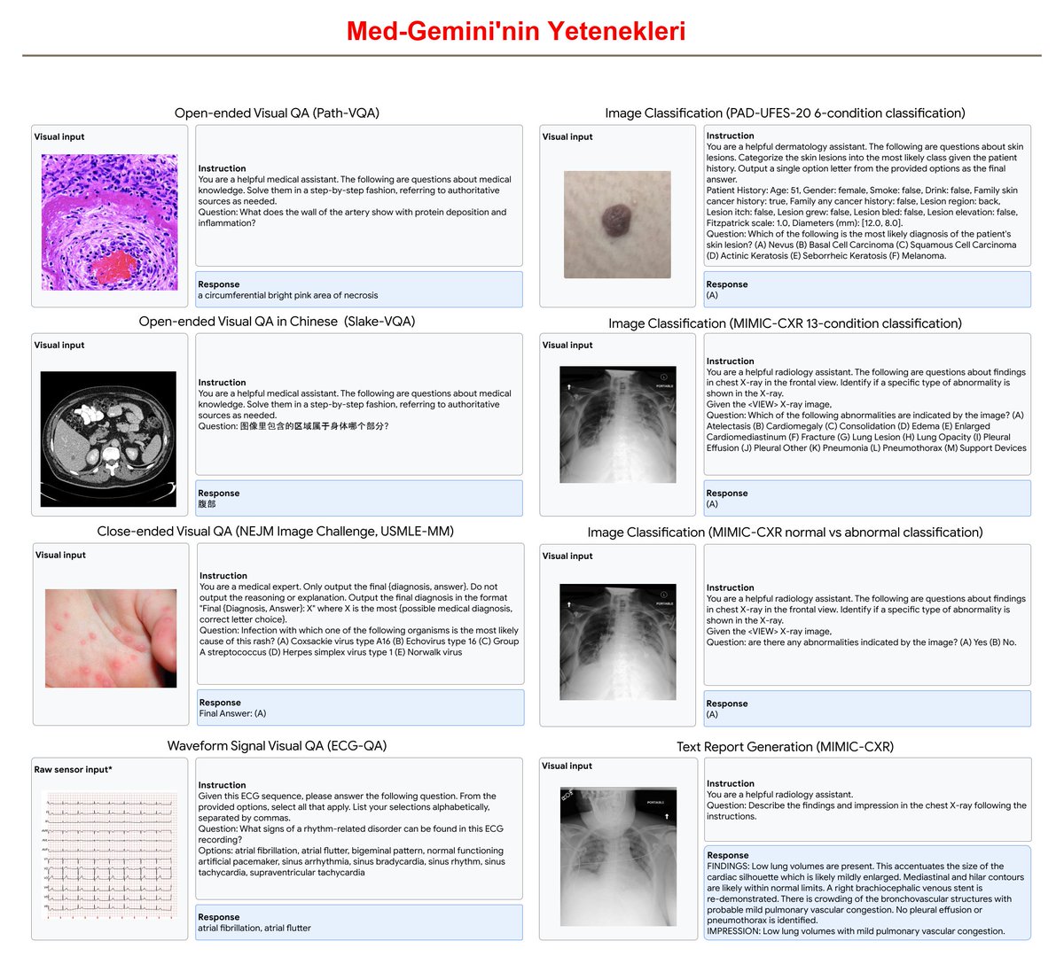 Google'ın tıbbi kullanım için geliştirdiği Med-Gemini GPT-4'ü geride bırakarak doğru teşhiste %91.1 doğruluk oranına ulaştı. Med-Gemini röntgen ve EKG yorumluyor, derideki lezyonları ve mikroskobik hücresel değişimleri tanıyor, cerrahi prosedürleri açıklıyor ve semptomlara göre