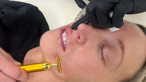Ready to pucker up? 😘 Our skilled team crafts each Lip Enhancement treatment to perfection, ensuring you leave with fuller lips and a confidence boost. 💋

Have you ever had Lip Fillers? Share your experience in the comments!

🌐 theklinic.co
