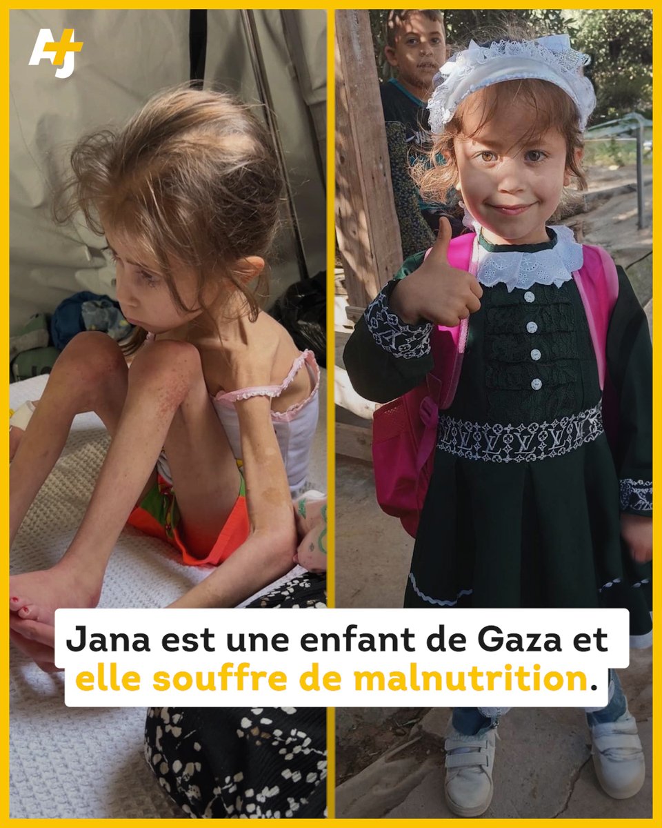 Sur les deux images, la même enfant. La petite Jana Ayad avant et après le siège et la guerre de l’occupant israélien contre la bande de Gaza. Des appels pour la sauver ont été lancés. Ces photos montrent l’ampleur de la souffrance des enfants de Gaza, victimes de cette guerre.…