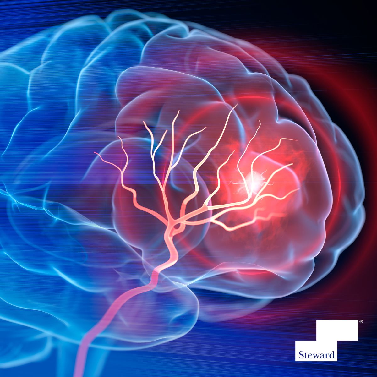 This #StrokeAwarenessMonth, be prepared to take immediate action; your quick response can make a #lifesaving difference! Learn the signs of a #stroke and empower yourself to #BEFAST: bit.ly/49yesqC