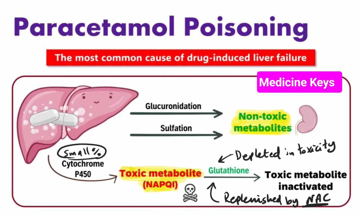 Remember, hepatic P450 inducers (e.g., chronic alcohol use) increase the risk of paracetamol poisoning. 

You can try our topics and flashcards from here:
medicinekeys.com/topic_system/m… 

Our aim is to cover all high-yield facts for MRCP exams and internal medicine.

#MRCP
#MRCP_UK