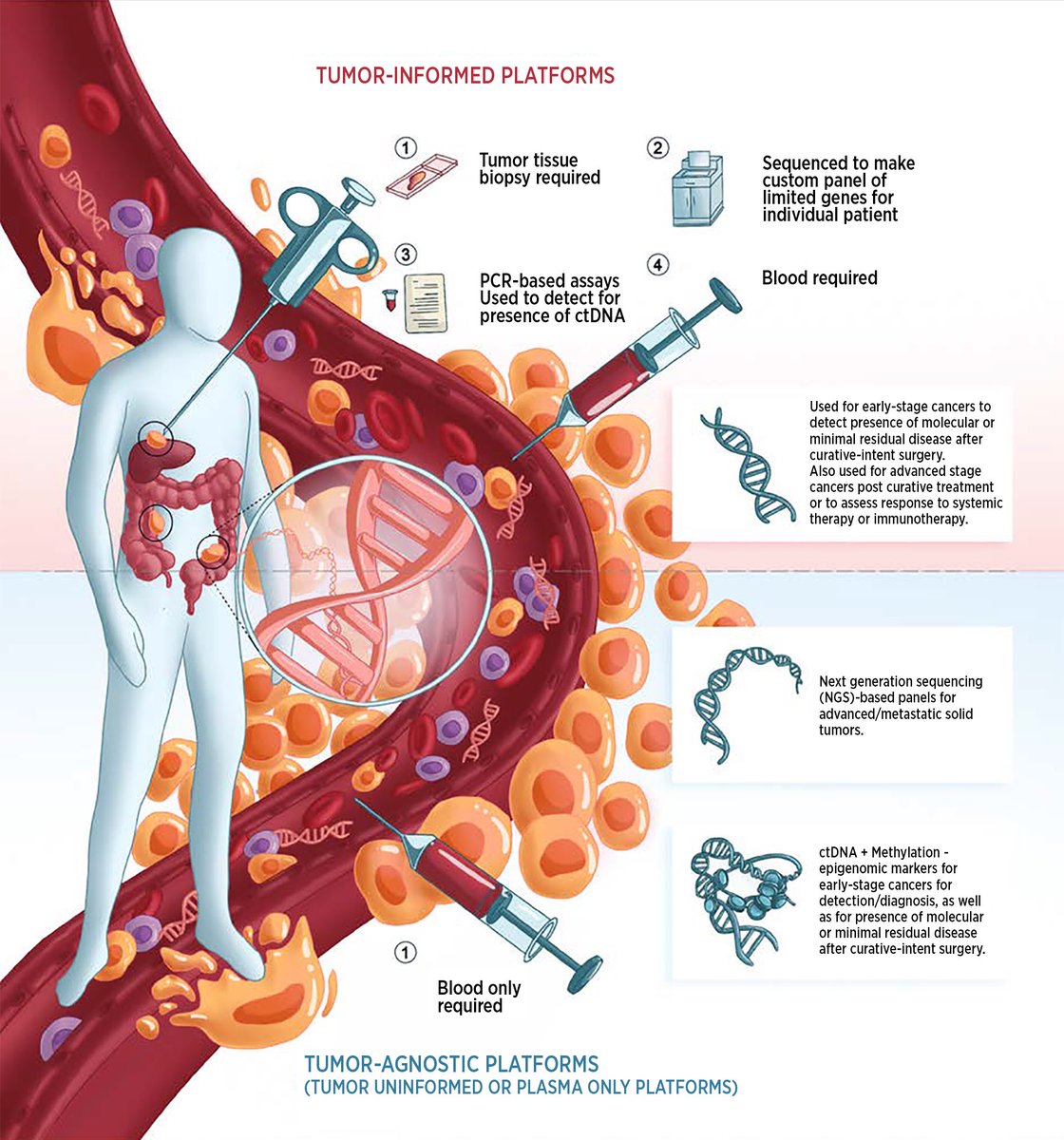 #ctDNA🧬can be broadly divided into tumor-informed🔬🆚tumor-naive🩸 platforms. Different lenses🔎of looking at the cancer through a blood draw.

Depending on the clinical question & tumor type, different types available.

#ASCODailyNews @ASCO @DrawImpacts 
dailynews.ascopubs.org/do/ctdna-assay…