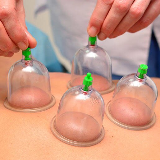 Have you guys tried hijama (cupping) therapy before? I did it on Sunday and the experience has been amazing from a health perspective. I highly recommend it.