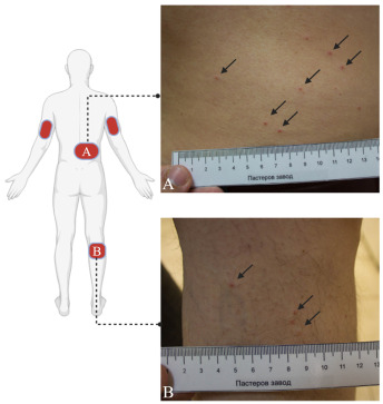 Alejandro Cabezas-Cruz tweet media