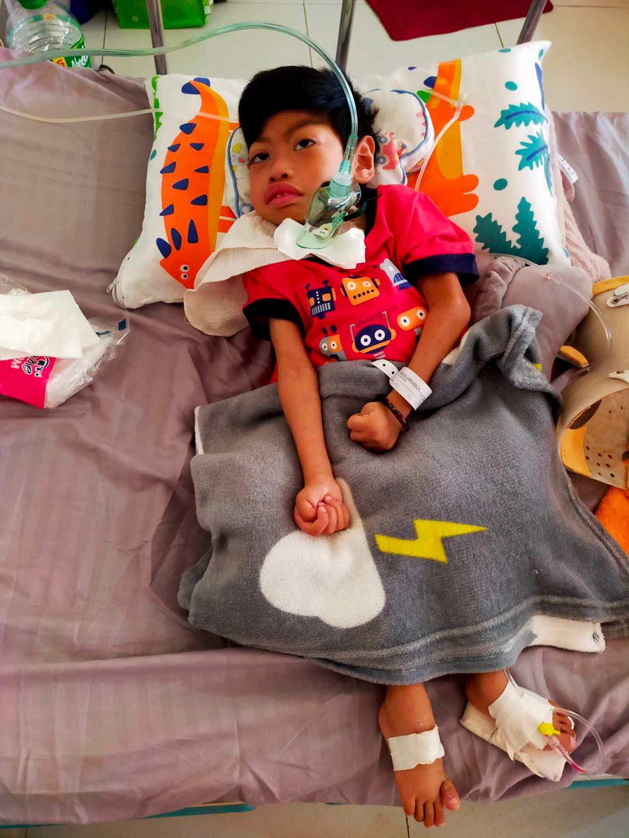 Lars has his tracheostomy surgery and is currently in recovery. His scoliosis worsened, the surgery aims to help  with his breathing. Thank you so much to all the sponsors who shared help to make this happen.