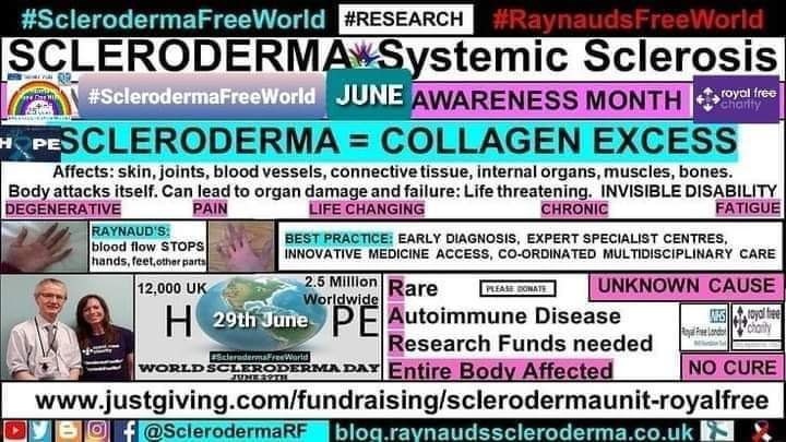 The countdown is on, 1 month until #SclerodermaAwarenessMonth 🌻 
Flashback 2017: 
blog.raynaudsscleroderma.co.uk/2017/07/flashb…
Donate: royalfreecharity.org/donate #SclerodermaFreeWorld #RaynaudsFreeWorld 
#Research #Scleroderma #SystemicSclerosis #Raynauds #Autoimmune #RareDisease #NoCure #UnknownCause
