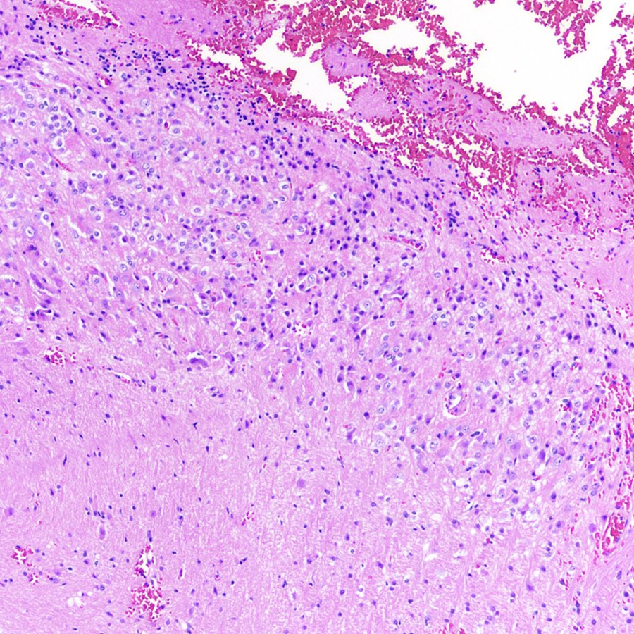 Craig Horbinski tweet media