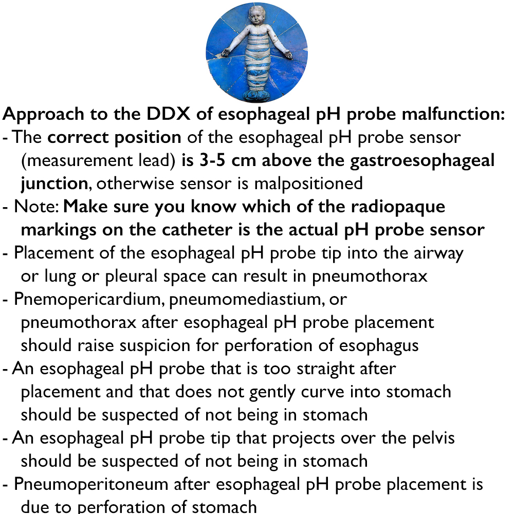 Approach to the differential diagnosis of esophageal pH probe malfunction:
- The correct position of the esophageal pH probe sensor is 3-5 cm above the gastroesophageal junction, otherwise sensor is malpositioned
#FOAMed #FOAMPed #FOAMRad #MedEd #PedsRad #RadEd #RadRes #radiology