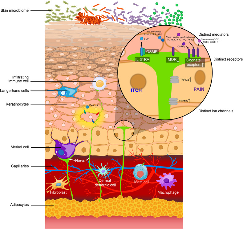 Similarities and differences in peripheral #itch and #pain pathways in atopic dermatitis spkl.io/601142a41 #atopicdermatitis