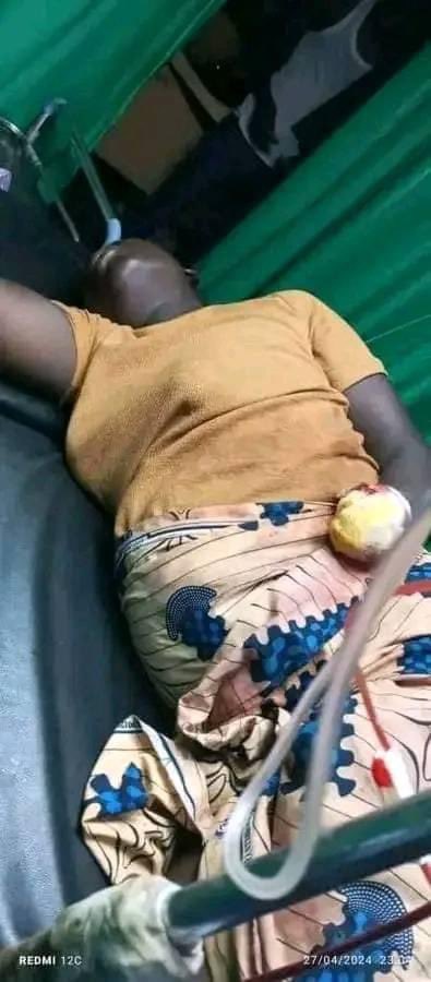 An alleged yoruba man cut off his wife's hand in Jos because she took 3k from the 20k he has been saving in Plateau State.Nigerian is fake country
